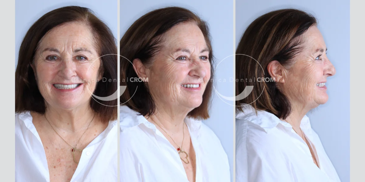 antes-y-despues-14
