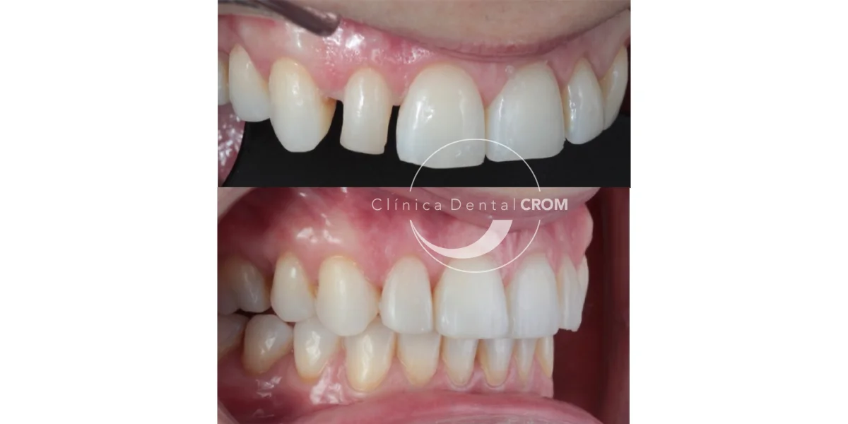 antes-y-despues-49